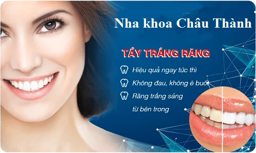 Tẩy trắng răng