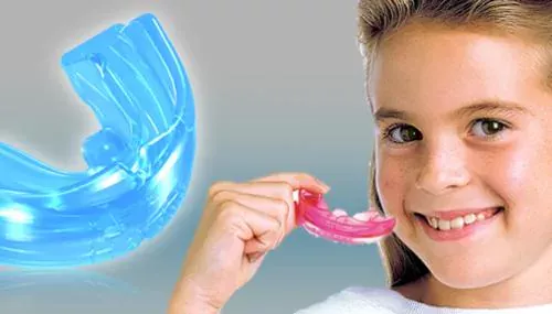 Niềng răng tháo lắp giúp trẻ định hình răng sớm Niềng răng mắc cài 2