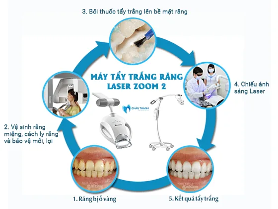 Tẩy trắng răng 2