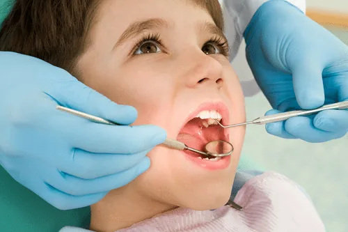 Cần nhổ răng sữa để răng vĩnh viễn không bị mọc lêch lạc